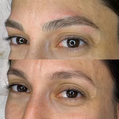 microblading